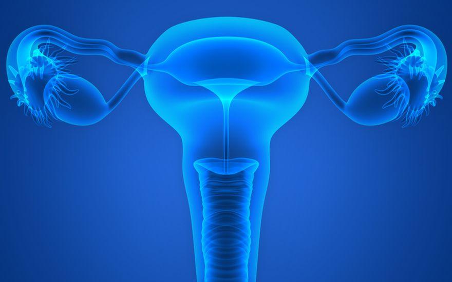 grafika - endometrioza